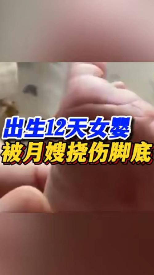 刚出生的宝宝，要怎么护理女婴被月嫂挠伤脚底视频女婴被月嫂挠伤脚底